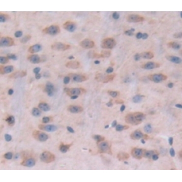 Protein O-Mannosyltransferase 1 (POMT1) Mouse Polyclonal Antibody