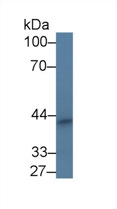 Periphilin 1 (PPHLN1) Mouse Polyclonal Antibody