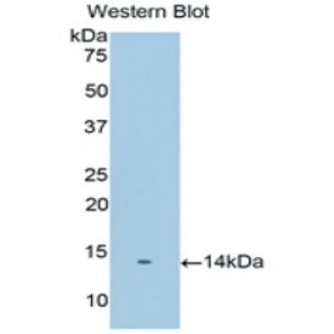 Prostate Stem Cell Antigen (PSCA) Human Polyclonal Antibody