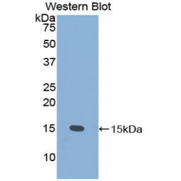 Prostate Stem Cell Antigen (PSCA) Human Polyclonal Antibody