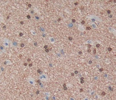 Poly U Binding Splicing Factor 60kDa (PUF60) Human Polyclonal Antibody