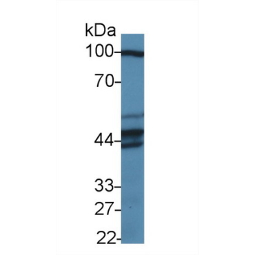 Pseudouridylate Synthase 1 (PUS1) Human Polyclonal Antibody