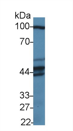 Pseudouridylate Synthase 1 (PUS1) Human Polyclonal Antibody