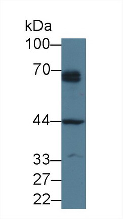 Parathyroid Hormone Receptor 1 (PTHR1) Human Polyclonal Antibody