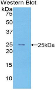 Peripheral Myelin Protein 22 (PMP22) Human Polyclonal Antibody