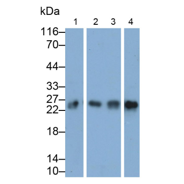 Peroxiredoxin 1 (PRDX1) Human Polyclonal Antibody