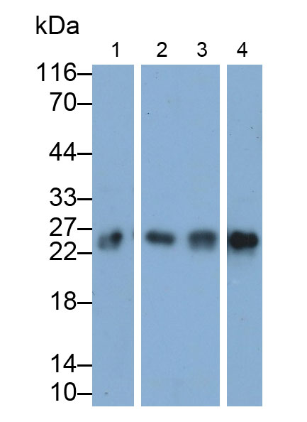 Peroxiredoxin 1 (PRDX1) Human Polyclonal Antibody