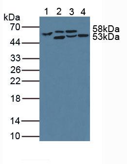 Phenylalanine Hydroxylase (PAH) Human Polyclonal Antibody