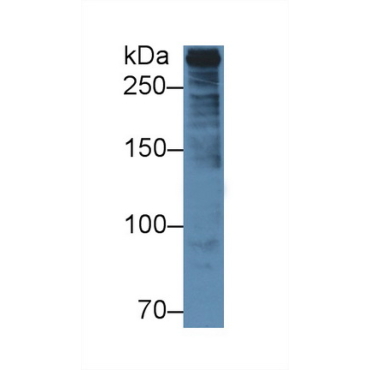 Plectin (PLEC) Human Polyclonal Antibody