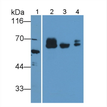 Prosaposin (PSAP) Human Polyclonal Antibody
