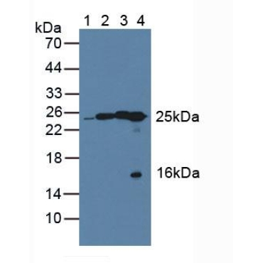 Quinoid Dihydropteridine Reductase (QDPR) Human Polyclonal Antibody