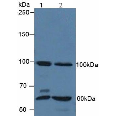 Quiescin Q6 Sulfhydryl Oxidase 1 (QSOX1) Human Polyclonal Antibody