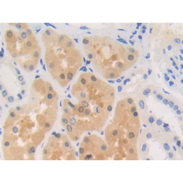 Renin Binding Protein (RENBP) Human Polyclonal Antibody