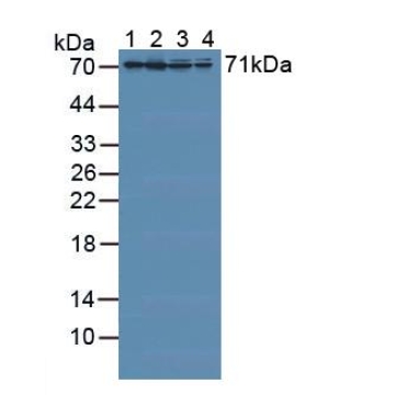 Radixin (RDX) Human Polyclonal Antibody