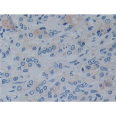Reelin (RELN) Human Polyclonal Antibody
