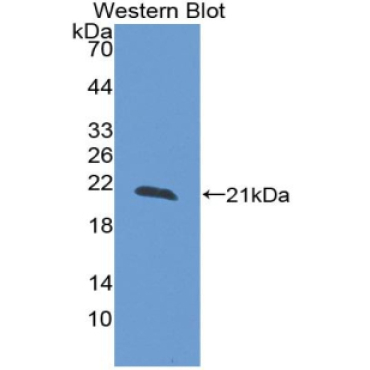 Reelin (RELN) Human Polyclonal Antibody