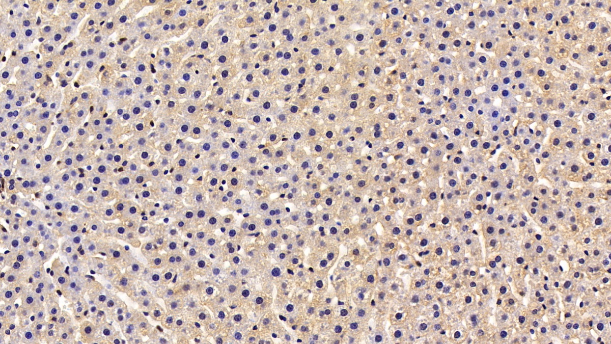 Reelin (RELN) Rat Polyclonal Antibody