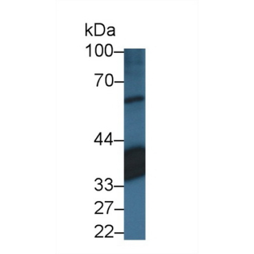 Retinaldehyde Binding Protein 1 (RLBP1) Human Polyclonal Antibody
