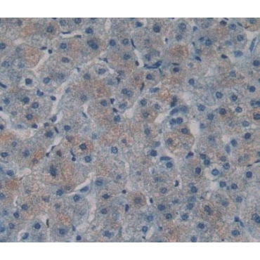T-Cell Lymphoma Invasion And Metastasis Inducing Protein 1 (TIAM1) Human Polyclonal Antibody