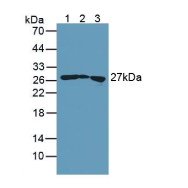 Transgelin (TAGLN) Human Polyclonal Antibody
