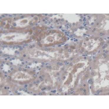 Threonine Aspartase 1 (TASP1) Human Polyclonal Antibody