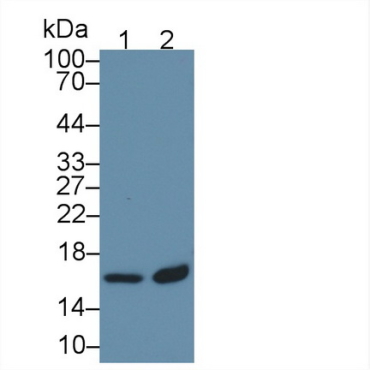 Tubulin Folding Cofactor A (TBCA) Human Polyclonal Antibody