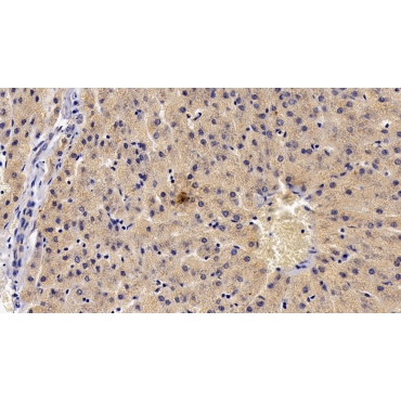 Tec Protein Tyrosine Kinase (TEC) Human Polyclonal Antibody