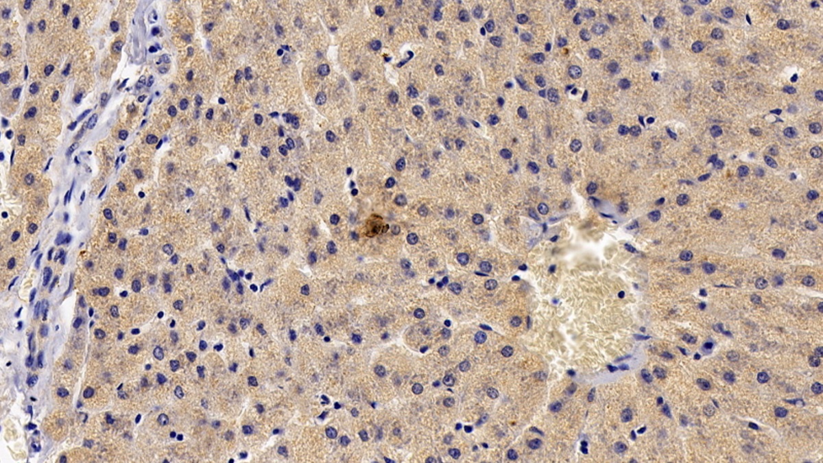 Tec Protein Tyrosine Kinase (TEC) Human Polyclonal Antibody