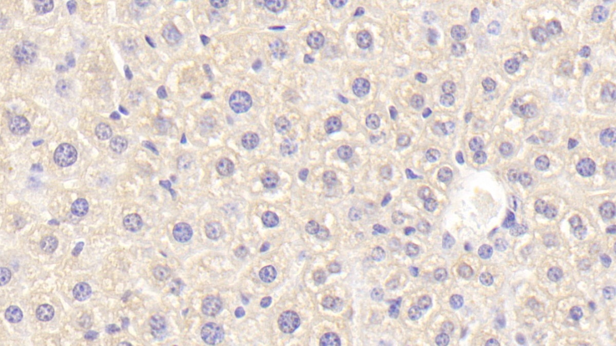 Tec Protein Tyrosine Kinase (TEC) Mouse Polyclonal Antibody