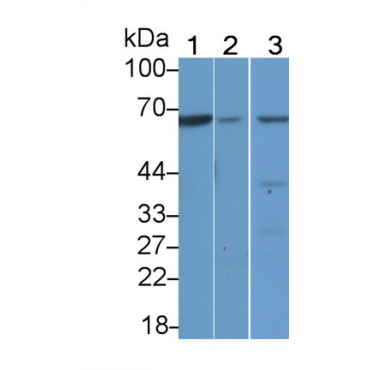Testis Specific Kinase 1 (TESK1) Human Polyclonal Antibody
