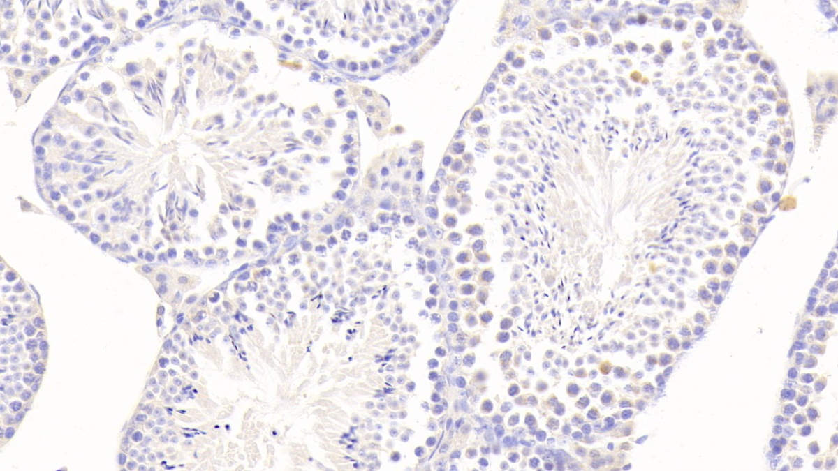 Testis Specific Kinase 1 (TESK1) Mouse Polyclonal Antibody