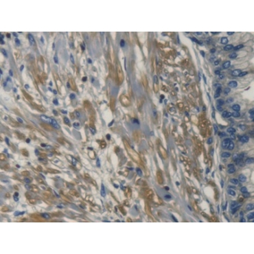 Transmembrane Protein 1 (TMEM1) Human Polyclonal Antibody