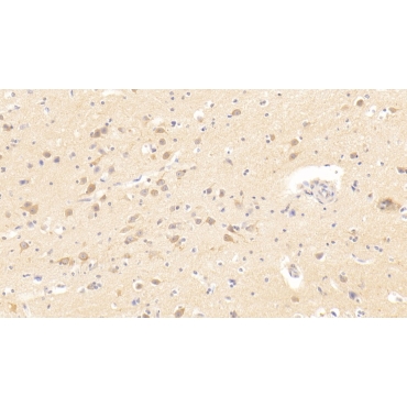 Transmembrane Protease, Serine 2 (TMPRSS2) Human Polyclonal Antibody