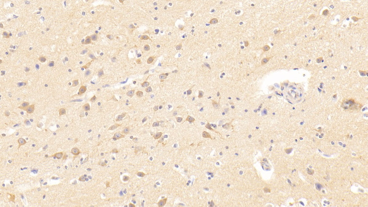 Transmembrane Protease, Serine 2 (TMPRSS2) Human Polyclonal Antibody