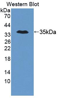 Trinucleotide Repeat Containing Protein 6A (TNRC6A) Mouse Polyclonal Antibody