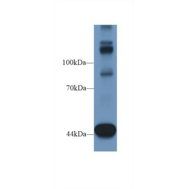 Tensin 1 (TNS1) Human Polyclonal Antibody