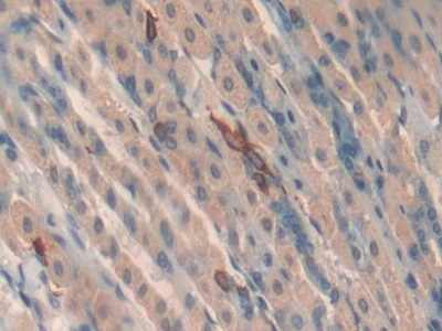 Toll Interacting Protein (TOLLIP) Mouse Polyclonal Antibody