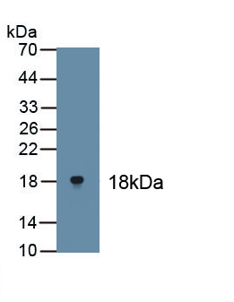 Tumor Protein P63 (TP63) Mouse Polyclonal Antibody