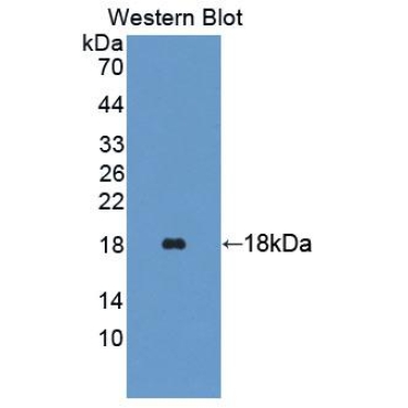 Trafficking Protein Particle Complex 2 (TRAPPC2) Human Polyclonal Antibody