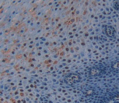 Transcriptional Regulating Factor 1 (TRERF1) Human Polyclonal Antibody