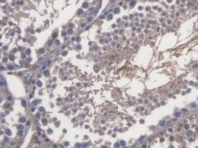Transcriptional Regulating Factor 1 (TRERF1) Mouse Polyclonal Antibody