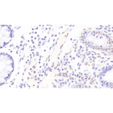 Three Prime Repair Exonuclease 1 (TREX1) Human Polyclonal Antibody