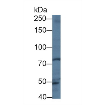 Trophinin (TRO) Human Polyclonal Antibody