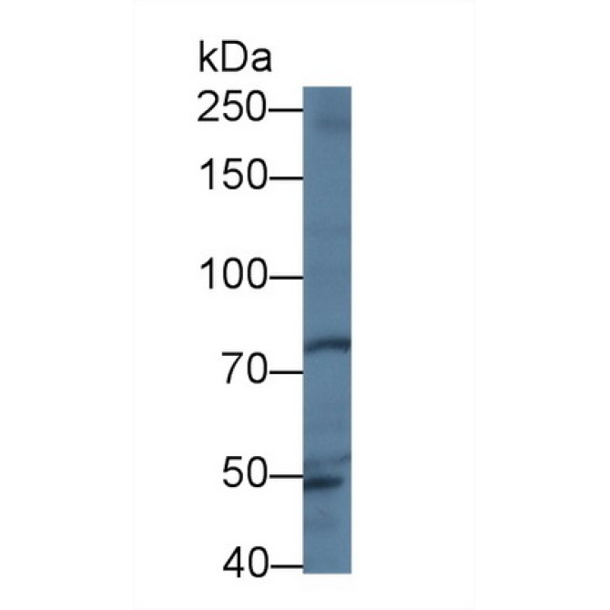 Trophinin (TRO) Human Polyclonal Antibody