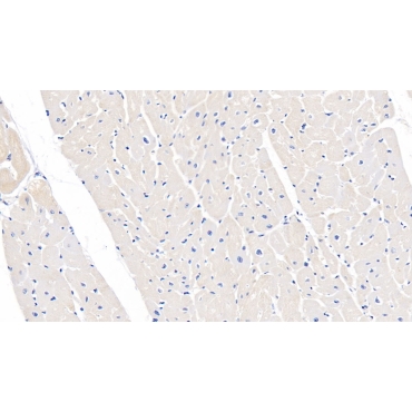 Tuberous Sclerosis Protein 1 (TSC1) Human Polyclonal Antibody