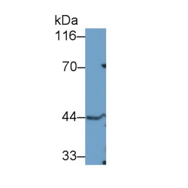 Tumor Susceptibility Gene 101 (TSG101) Human Polyclonal Antibody