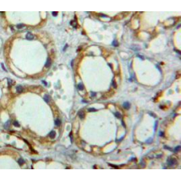 Tetraspanin 3 (TSPAN3) Human Polyclonal Antibody