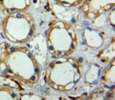 Tetraspanin 3 (TSPAN3) Human Polyclonal Antibody