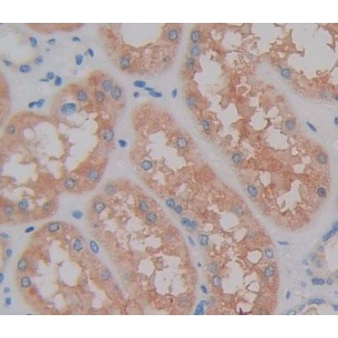 Thiosulfate Sulfurtransferase (TST) Human Polyclonal Antibody