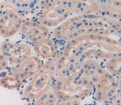 Tissue Specific Transplantation Antigen P35B (TSTA3) Mouse Polyclonal Antibody